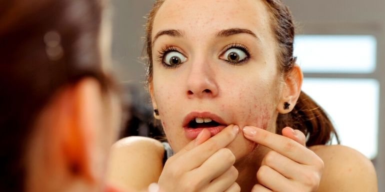 adolescents acné sophrologie